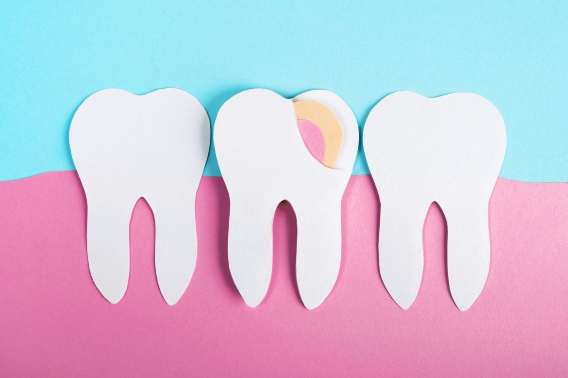 Too Much Red Meat May Worsen Gum Health